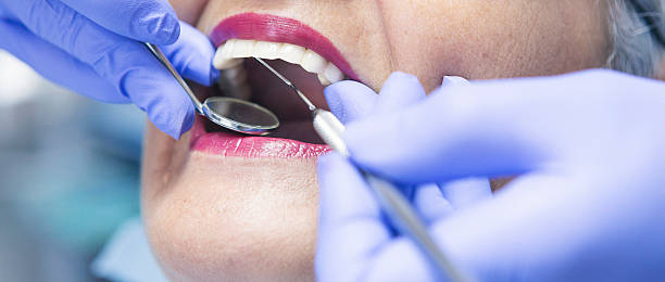 Best Emergency Wisdom Teeth Removal in Fort Hood, TX